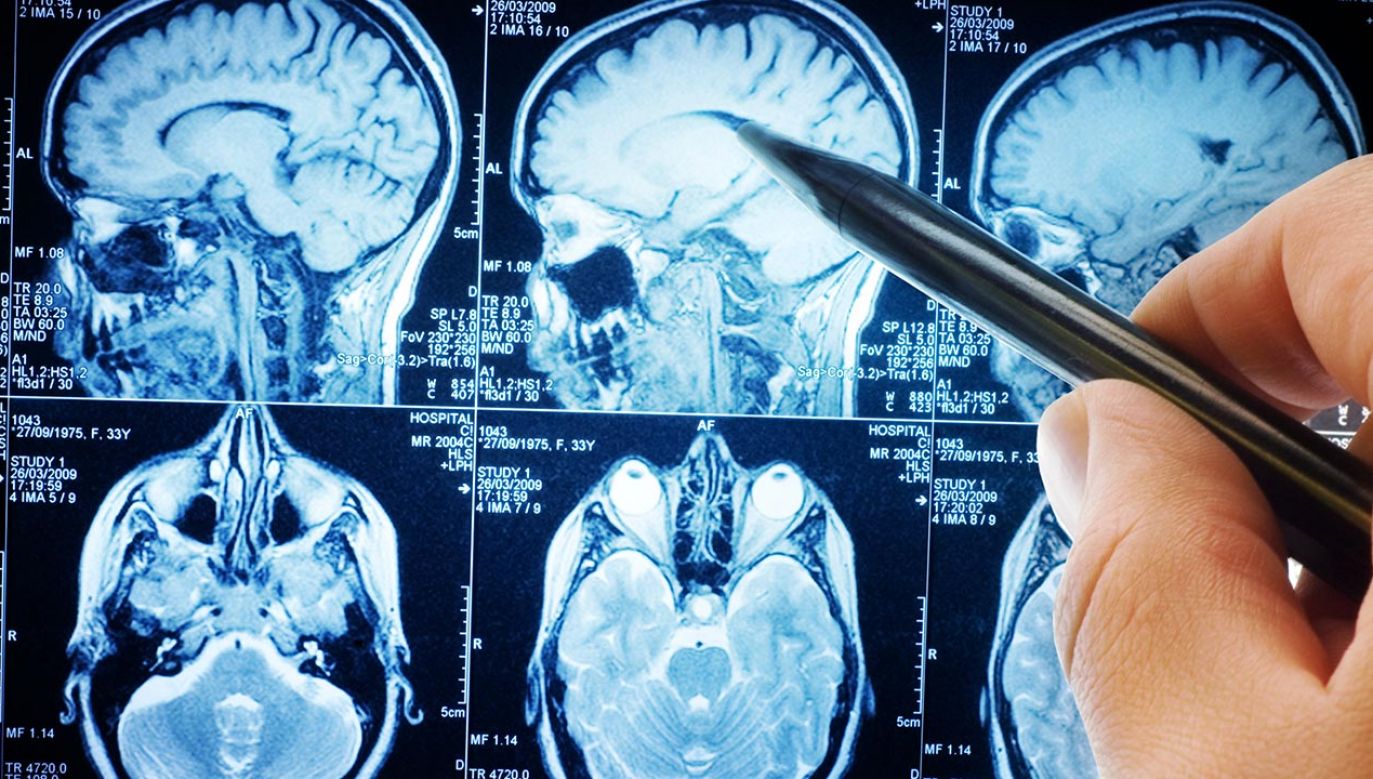  Udało się poznać ważne rejony mózgu odpowiedzialne za myślenie (fot. Shutterstock/Triff)