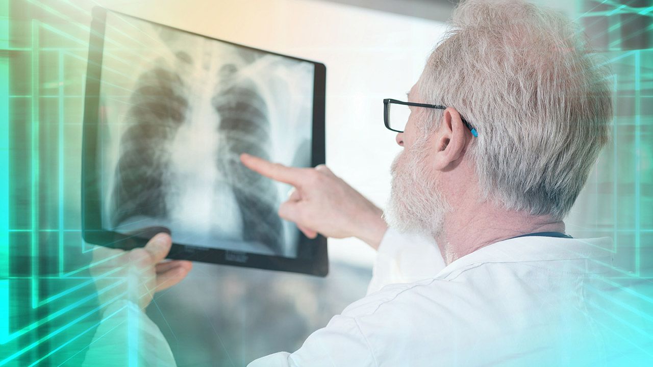 Liczba zachorowań i zgonów z powodu ciężkiej choroby płuc stale rośnie (fot. Shutterstock/thodonal88)